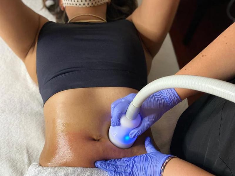 Cryo slimming treatment at Zivel Riverton